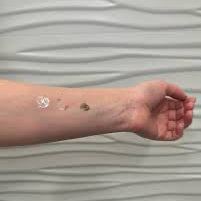 Patch test