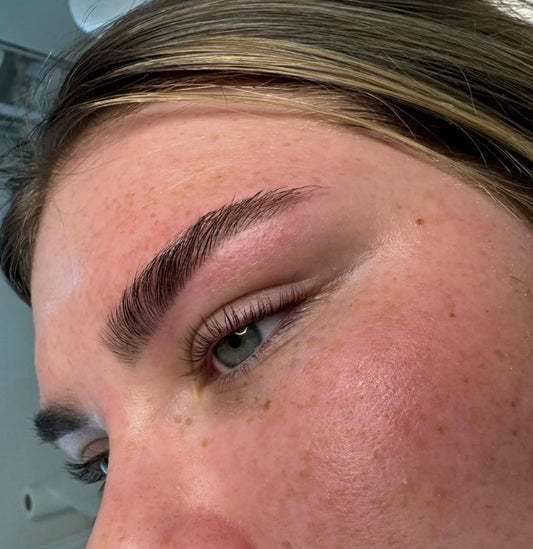 Brow lightning